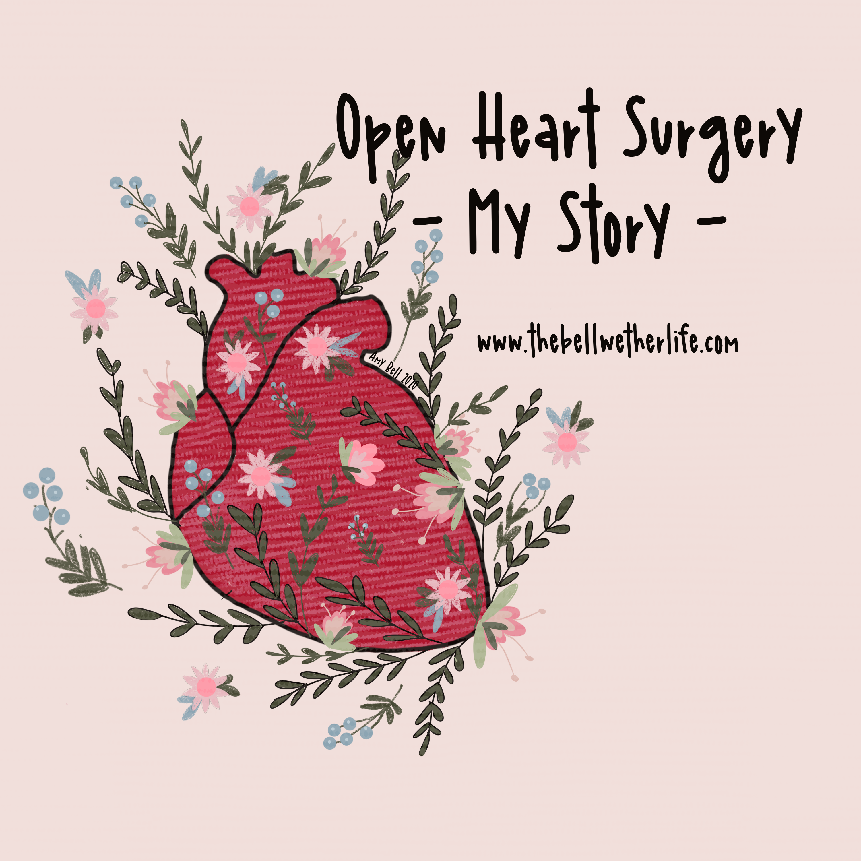 My Open Heart Surgery Story