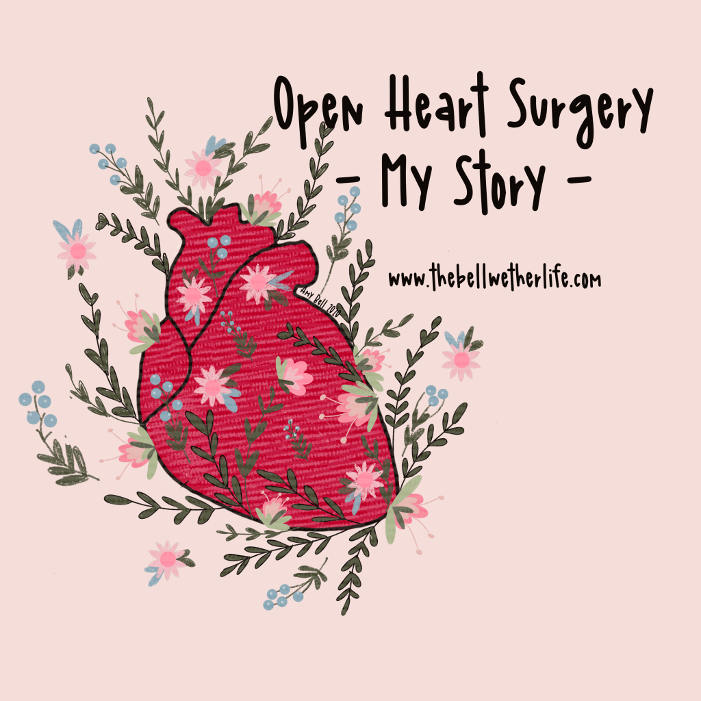 My Open Heart Surgery&nbsp;Story